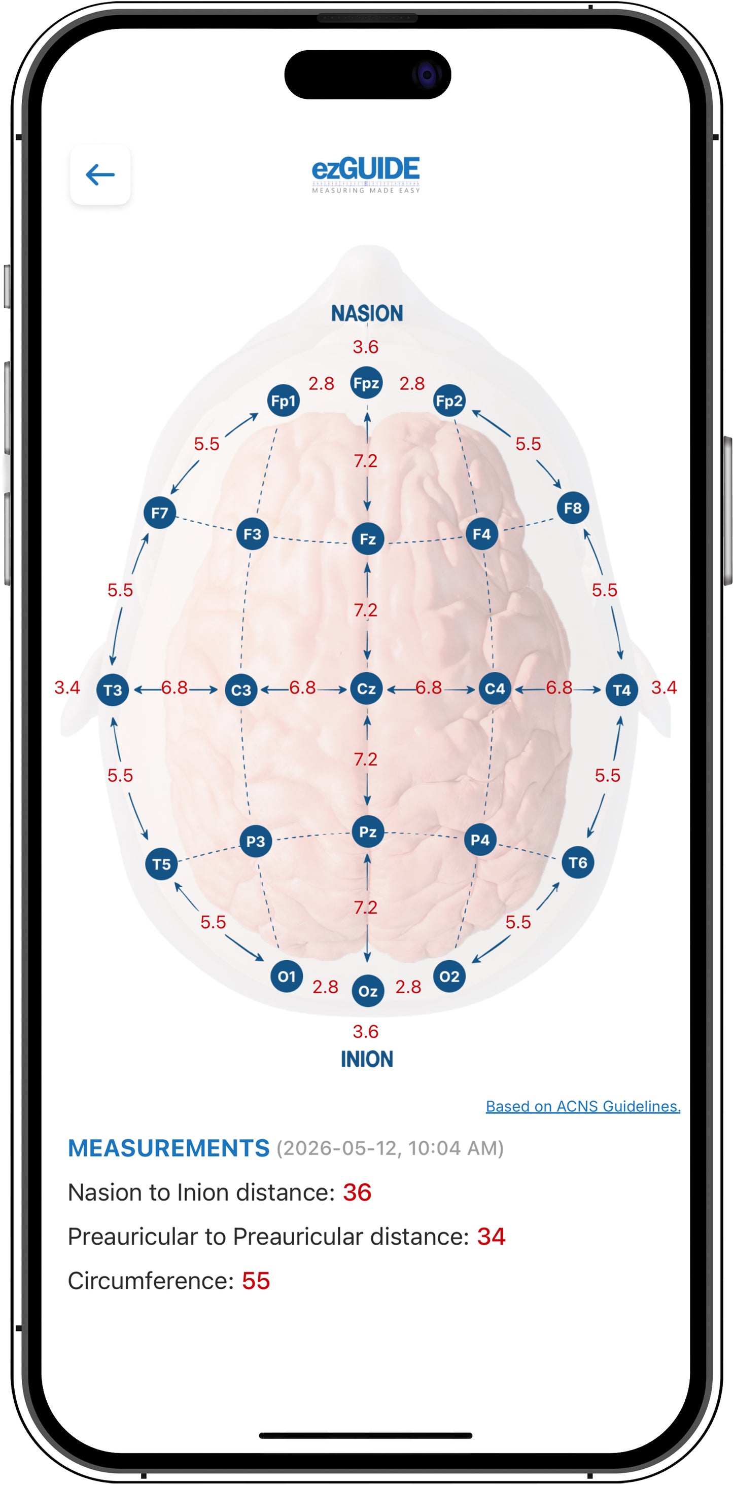 ezGUIDE EEG electrode placement calculator displaying patient-specific International 10-20 System electrode locations and calculated interelectrode distances based on three head measurements